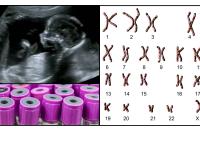 Diagnostik under graviditet, i foster og på nyfødte